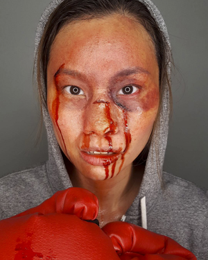 Boxer after a fight